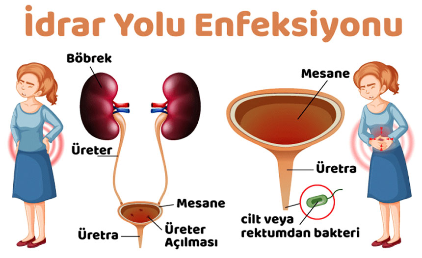 idrar-yolu-enfeksiyonu